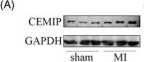 Fig.7.A showing Western Blotting from the publication: BMP6 knockdown enhances cardiac fibrosis in a mouse myocardial infarction model by upregulating AP-1/CEMIP expression.