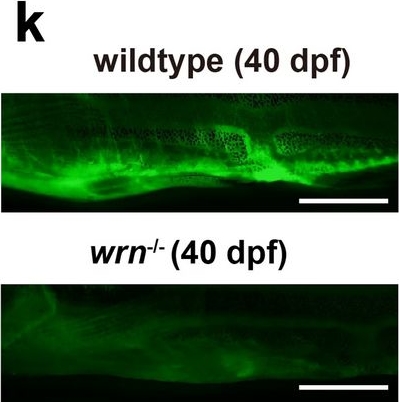 Fig.3.K showing Immunohistochemistry-immunofluorescence in a Danio rerio (Zebrafish) sample from the publication: WRN loss accelerates abnormal adipocyte metabolism in Werner syndrome.