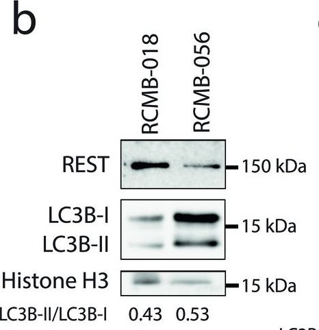 Fig.2.B showing Western Blotting in a Homo sapiens (Human) sample from the publication: REST-dependent downregulation of von Hippel-Lindau tumor suppressor promotes autophagy in SHH-medulloblastoma.