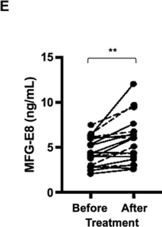 Fig.2.E showing Enzyme-linked immunosorbent assay in a Homo sapiens (Human) sample from the publication: Serum milk fat globule-EGF factor 8 (MFG-E8) as a diagnostic and prognostic biomarker in patients with hepatocellular carcinoma.