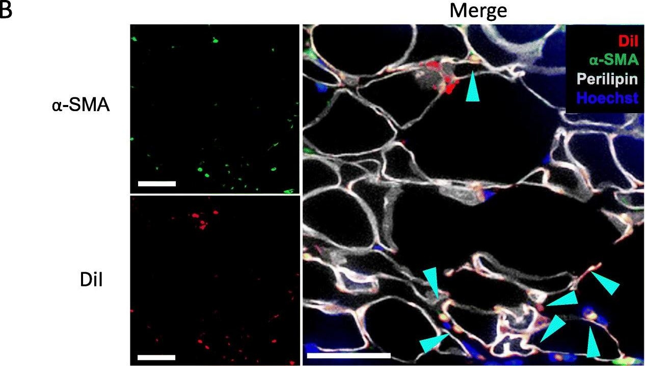 3D co-culture model of endothelial colony-forming cells (ECFCs) reverses late passage adipose-derived stem cell senescence for wound healing.