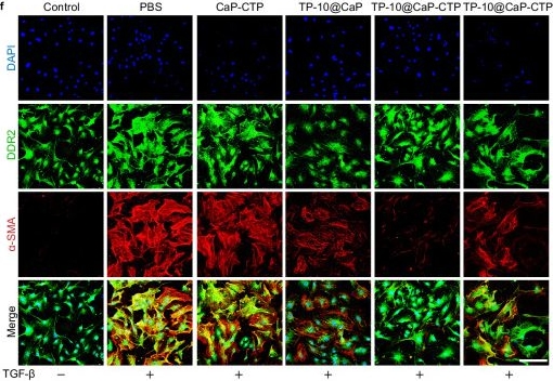 Fig.5.F showing Immunocytochemistry-immunofluorescence from the publication: Inhalable cardiac targeting peptide modified nanomedicine prevents pressure overload heart failure in male mice.