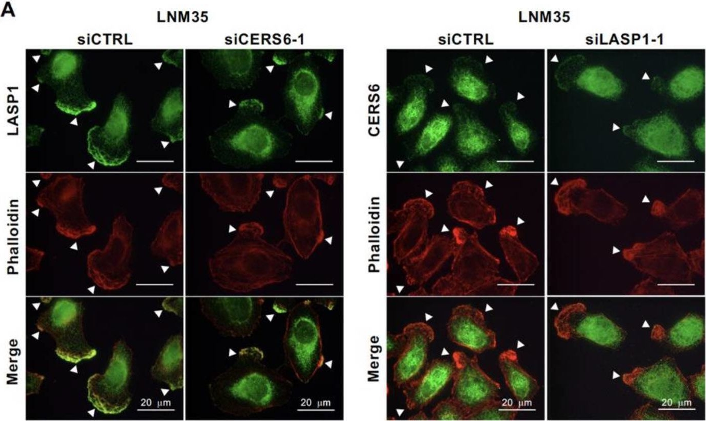 Fig.5.A showing Immunocytochemistry-immunofluorescence in a Homo sapiens (Human) sample from the publication: LASP1, CERS6, and Actin Form a Ternary Complex That Promotes Cancer Cell Migration.