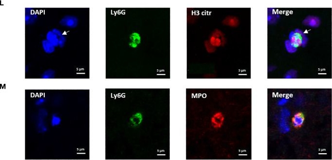 Fig.2.L showing Immunocytochemistry-immunofluorescence in a Mus musculus (House mouse) sample from the publication: ß1-adrenergic blockers preserve neuromuscular function by inhibiting the production of extracellular traps during systemic inflammation in mice.