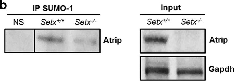 Fig.2.B showing Western Blotting in a Mus musculus (House mouse) sample from the publication: Senataxin controls meiotic silencing through ATR activation and chromatin remodeling.