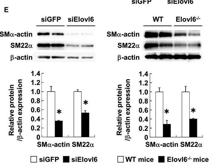 Fig.2.E showing Western Blotting in a Mus musculus (House mouse) sample from the publication: Elongation of Long-Chain Fatty Acid Family Member 6 (Elovl6)-Driven Fatty Acid Metabolism Regulates Vascular Smooth Muscle Cell Phenotype Through AMP-Activated Protein Kinase/Krüppel-Like Factor 4 (AMPK/KLF4) Signaling.