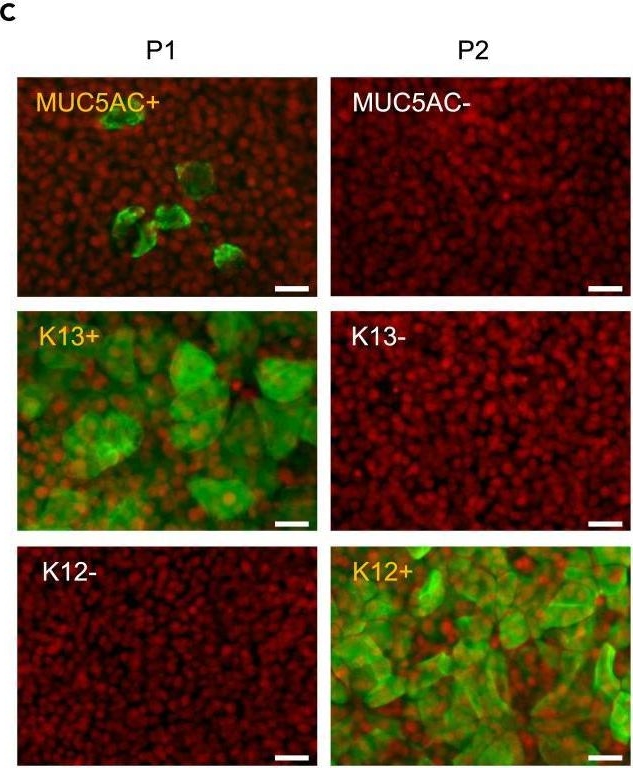 Fig.4.C showing Immunocytochemistry-immunofluorescence in a Homo sapiens (Human) sample from the publication: Identification of BST2 as a conjunctival epithelial stem/progenitor cell marker.