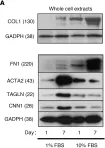 Fig.2.A showing Western Blotting from the publication: NKX2-5 regulates vessel remodeling in scleroderma-associated pulmonary arterial hypertension.