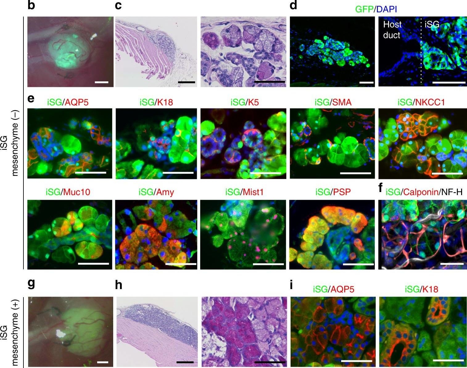 Generation of orthotopically functional salivary gland from embryonic stem cells.