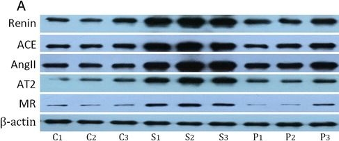 Fig.4.A showing Western Blotting in a Canis lupus familiaris (Domestic dog) sample from the publication: Pulmonary artery denervation improves pulmonary arterial hypertension induced right ventricular dysfunction by modulating the local renin-angiotensin-aldosterone system.