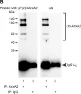 Fig.5.B showing Immunoprecipitation in a Rattus norvegicus (Rat) sample from the publication: Reactive oxygen species exert opposite effects on Tyr23 phosphorylation of the nuclear and cortical pools of annexin A2.