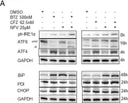 Fig.3.A showing Western Blotting from the publication: The cytotoxic activity of carfilzomib together with nelfinavir is superior to the bortezomib/nelfinavir combination in non-small cell lung carcinoma.