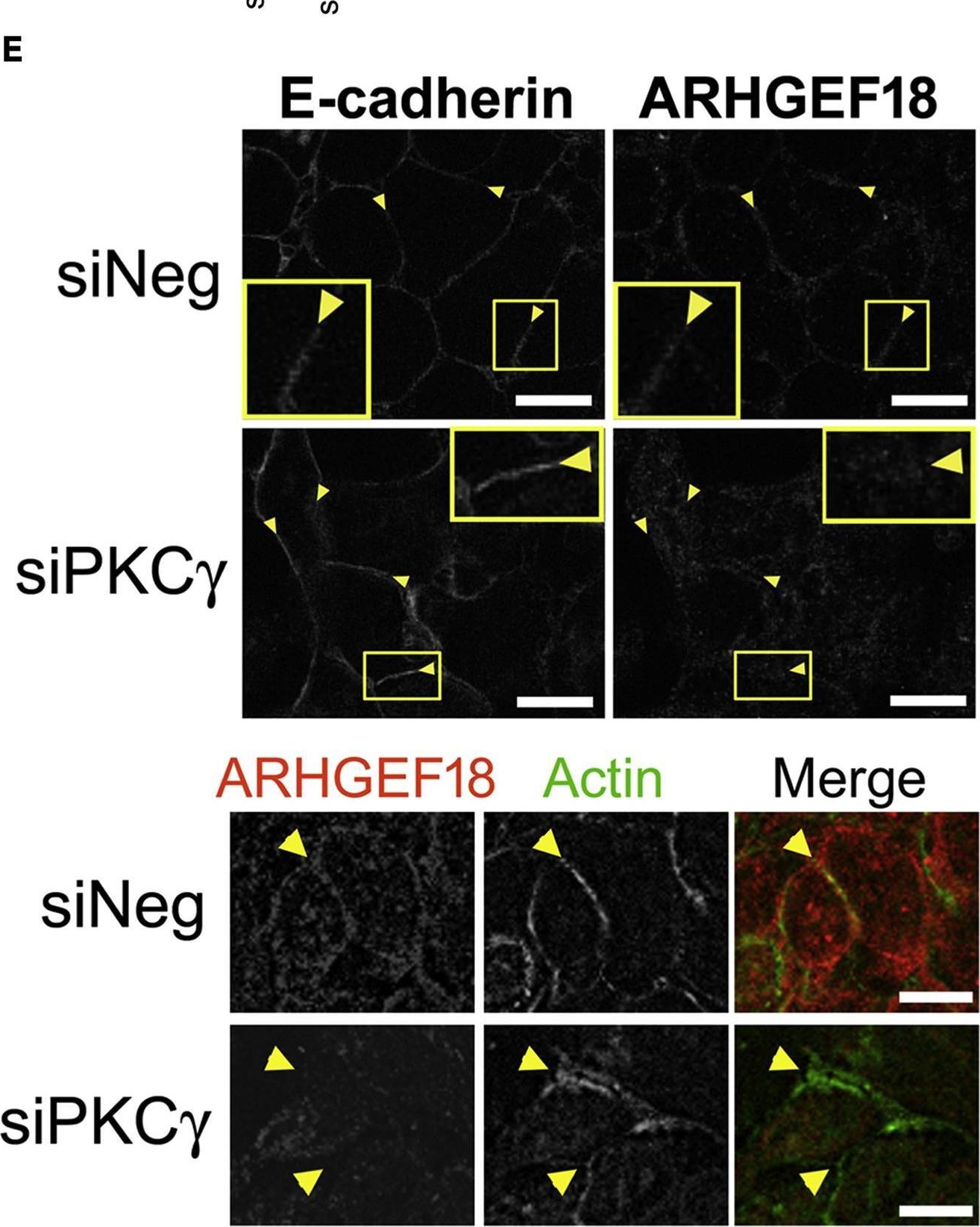 Fig.6.E showing Immunocytochemistry-immunofluorescence in a Homo sapiens (Human) sample from the publication: Downregulation of protein kinase C gamma reduces epithelial property and enhances malignant phenotypes in colorectal cancer cells.