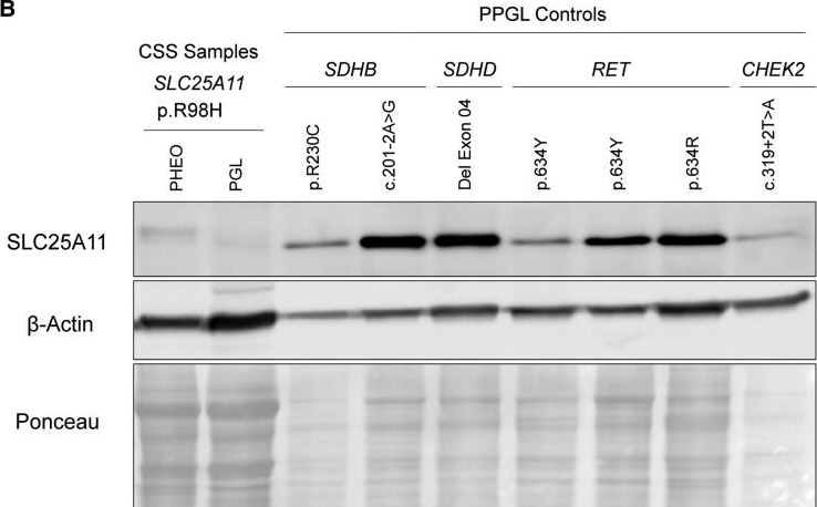 Fig.3.B showing Western Blotting in a Homo sapiens (Human) sample from the publication: SLC25A11, a Novel Gene Associated With Carney-Stratakis Syndrome.