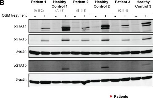 Fig.6.B showing Western Blotting in a Homo sapiens (Human) sample from the publication: Human germline biallelic loss-of-function OSMR variants cause severe allergic disease.