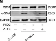 Fig.4.M showing Western Blotting from the publication: Semaphorin 7A promotes endothelial to mesenchymal transition through ATF3 mediated TGF-β2/Smad signaling.