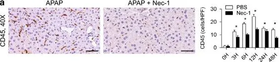 Fig.7.A showing Immunohistochemistry-paraffin in a Mus musculus (House mouse) sample from the publication: Divergent effects of RIP1 or RIP3 blockade in murine models of acute liver injury.