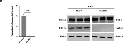 Fig.3.C showing Western Blotting in a Homo sapiens (Human) sample from the publication: Influence of EGF and pro-NGF on EGFR/SORTILIN interaction and clinical impact in head and neck squamous cell carcinoma.
