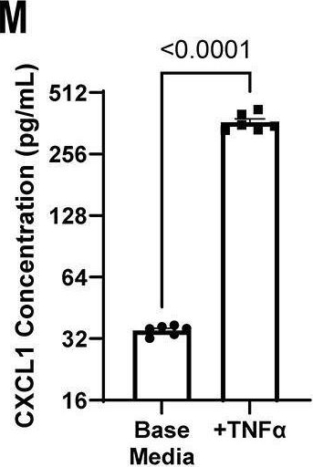 Fig.4.M showing Enzyme-linked immunosorbent assay from the publication: Tumor-derived interleukin-1α and leukemia inhibitory factor promote extramedullary hematopoiesis.