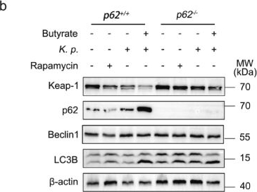 Fig.4.B showing Western Blotting from the publication: Butyrate protects against Klebsiella pneumoniae-induced oxidative stress in alveolar macrophages via p62-Keap1-Nrf2 pathway.