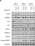 Fig.3.B showing Western Blotting from the publication: CDK8/19 inhibition induces premature G1/S transition and ATR-dependent cell death in prostate cancer cells.