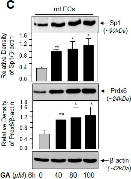 Fig.1.C showing Western Blotting in a Homo sapiens (Human) sample from the publication: Ginkgolic Acid Rescues Lens Epithelial Cells from Injury Caused by Redox Regulated-Aberrant Sumoylation Signaling by Reviving Prdx6 and Sp1 Expression and Activities.