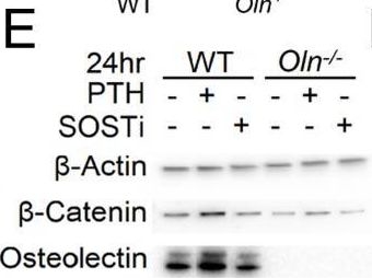 Fig.4.E showing Western Blotting from the publication: The effect of parathyroid hormone on osteogenesis is mediated partly by osteolectin.