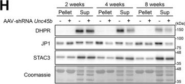 Fig.3.H showing Western Blotting in a Mus musculus (House mouse) sample from the publication: UNC45B Reduction With Aging: A Myofiber-Intrinsic Promoting Factor for Sarcopenia.