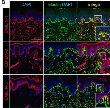 Fig.2.B showing Immunohistochemistry-immunofluorescence in a Homo sapiens (Human) sample from the publication: New insights into the structural role of EMILINs within the human skin microenvironment.