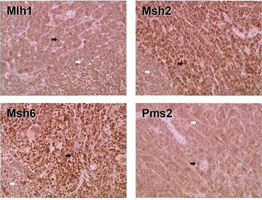Fig.3.B showing Immunohistochemistry in a Mus musculus (House mouse) sample from the publication: Azathioprine induction of tumors with microsatellite instability: risk evaluation using a mouse model.