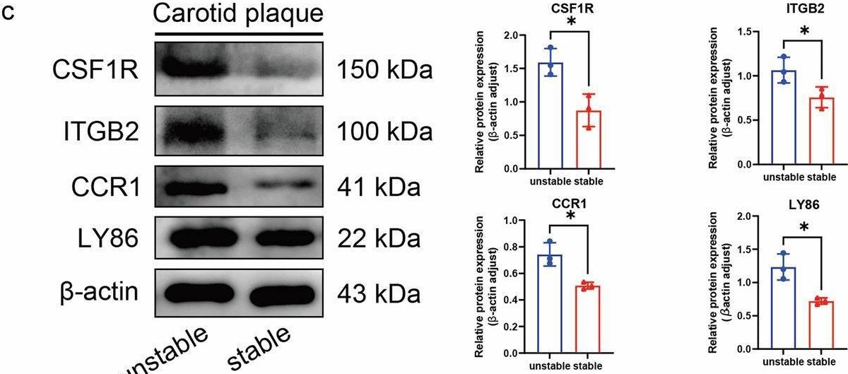 Fig.3.C showing Western Blotting in a Homo sapiens (Human) sample from the publication: Neutrophil extracellular traps mediate the crosstalk between plaque microenvironment and unstable carotid plaque formation.