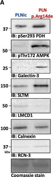 Fig.1.A showing Western Blotting from the publication: Impairment of the ER/mitochondria compartment in human cardiomyocytes with PLN p.Arg14del mutation.
