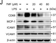 Fig.2.J showing Western Blotting from the publication: 7-Methoxyflavanone Alleviates LPS-Induced Acute Lung Injury by Suppressing TLR4/NF-κB p65 and ROS/Txnip/NLRP3 Signaling.