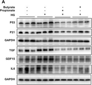 Fig.6.A showing Western Blotting from the publication: Time-Restricted Feeding Prevents Cardiac Aging by Entraining Gut Microbiota Clock and Promoting Diurnal Rhythm Autophagy in Prediabetic Mice.