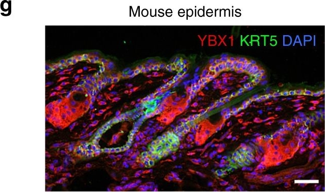The RNA-binding protein YBX1 regulates epidermal progenitors at a posttranscriptional level.