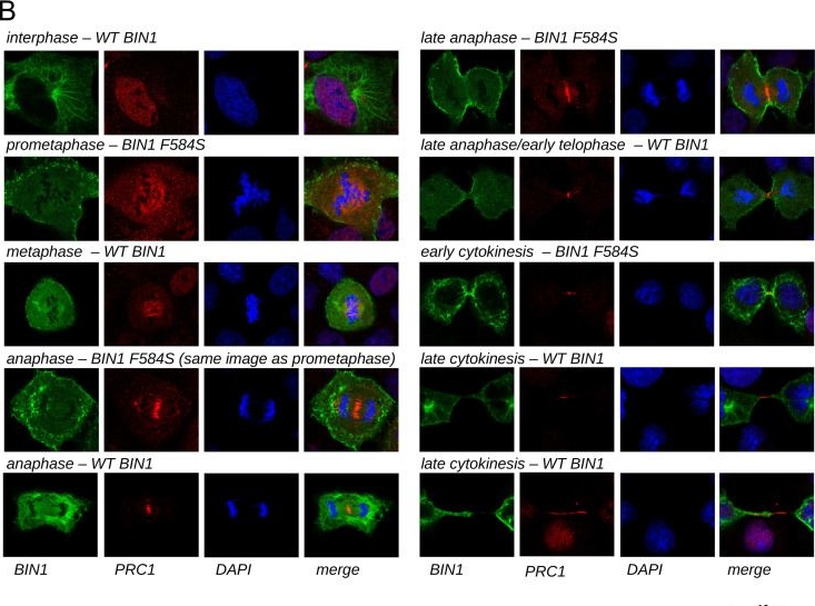 Fig.6.B showing Immunocytochemistry-immunofluorescence from the publication: Uncovering the BIN1-SH3 interactome underpinning centronuclear myopathy.