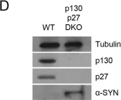 Fig.3.D showing Western Blotting from the publication: p27Kip1 regulates alpha-synuclein expression.