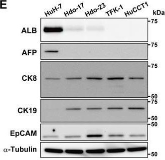 Development of hepatoma-derived, bidirectional oval-like cells as a model to study host interactions with hepatitis C virus during differentiation.