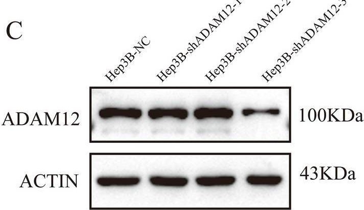 Fig.6.C showing Western Blotting from the publication: ADAM12 is an independent predictor of poor prognosis in liver cancer.