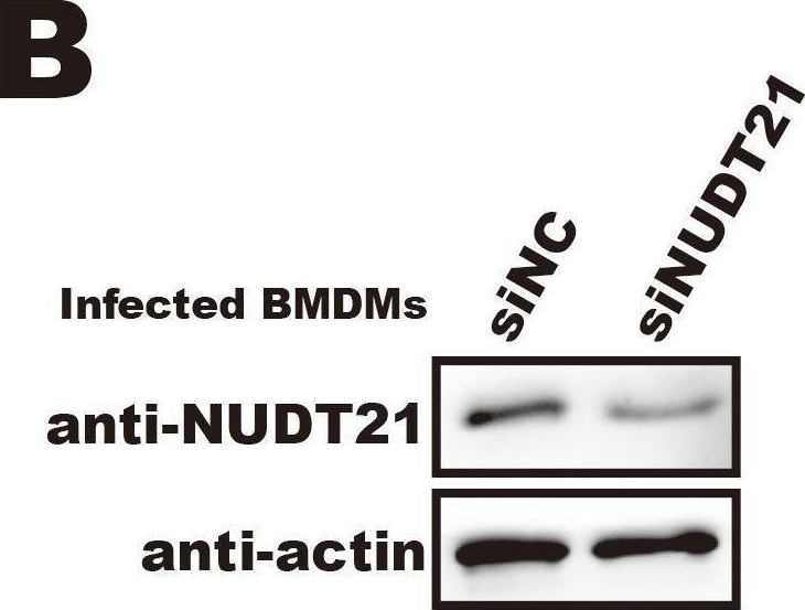 Fig.6.B showing Western Blotting from the publication: Mycobacterium tuberculosis modulates NUDT21-mediated alternative polyadenylation to enhance FTH1 expression in macrophages and promotes intracellular growth.