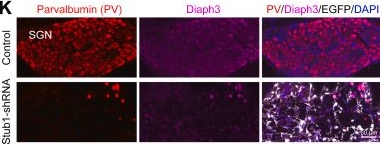 Fig.6.K showing Immunohistochemistry-immunofluorescence from the publication: Stub1 promotes degradation of the activated Diaph3: A&nbsp;negative feedback regulatory mechanism of the actin nucleator.