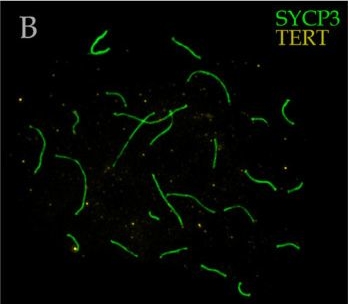 Fig.5.B showing Immunohistochemistry-immunofluorescence in a Rattus norvegicus (Rat) sample from the publication: Unusual RNA polymerase II patterns in meiotic prophase I in Nannospalax xanthodon: insights into chromatin, telomeres, and sex chromosomes.