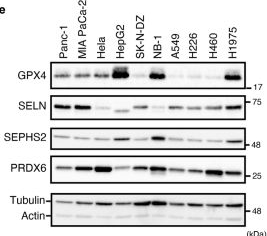 Fig.10.E showing Western Blotting from the publication: PRDX6 augments selenium utilization to limit iron toxicity and ferroptosis.