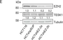 Fig.2.E showing Western Blotting from the publication: EZH2 regulates cofilin activity and colon cancer cell migration by targeting ITGA2 gene.