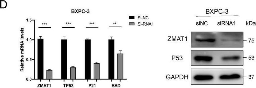 Fig.5.D showing Western Blotting in a Homo sapiens (Human) sample from the publication: ZMAT1 acts as a tumor suppressor in pancreatic ductal adenocarcinoma by inducing SIRT3/p53 signaling pathway.