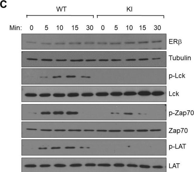 Fig.3.C showing Western Blotting in a Mus musculus (House mouse) sample from the publication: Estrogen receptor beta signaling in CD8+ T cells boosts T cell receptor activation and antitumor immunity through a phosphotyrosine switch.