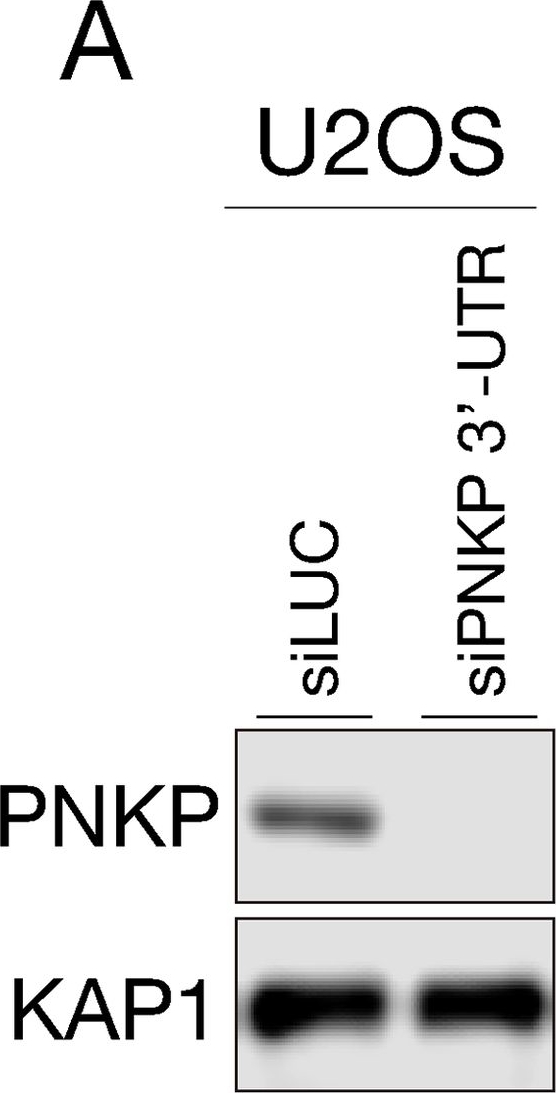Fig.4.A showing Western Blotting in a Homo sapiens (Human) sample from the publication: Linker region is required for efficient nuclear localization of polynucleotide kinase phosphatase.