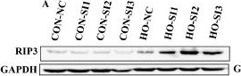 Fig.3.A showing Western Blotting from the publication: MLKL Deficiency Stabilizes RIP3 and Aggravates Myocardial Injury by Promoting Apoptosis and Pyroptosis.