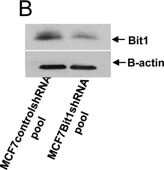 Fig.2.B showing Western Blotting from the publication: Metastasis of tumor cells is enhanced by downregulation of Bit1.