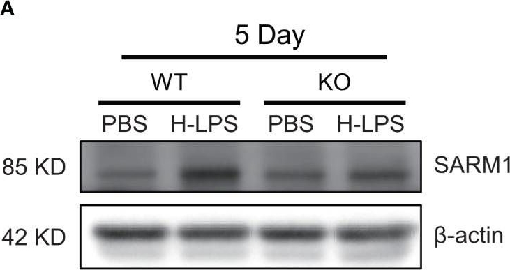 Fig.4.A showing Western Blotting in a Mus musculus (House mouse) sample from the publication: TRAM deletion attenuates monocyte exhaustion and alleviates sepsis severity.